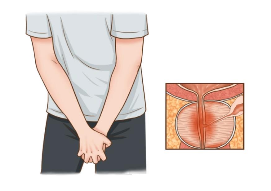 360截圖20250327105307005.jpg 前列腺凝膠oem廠家